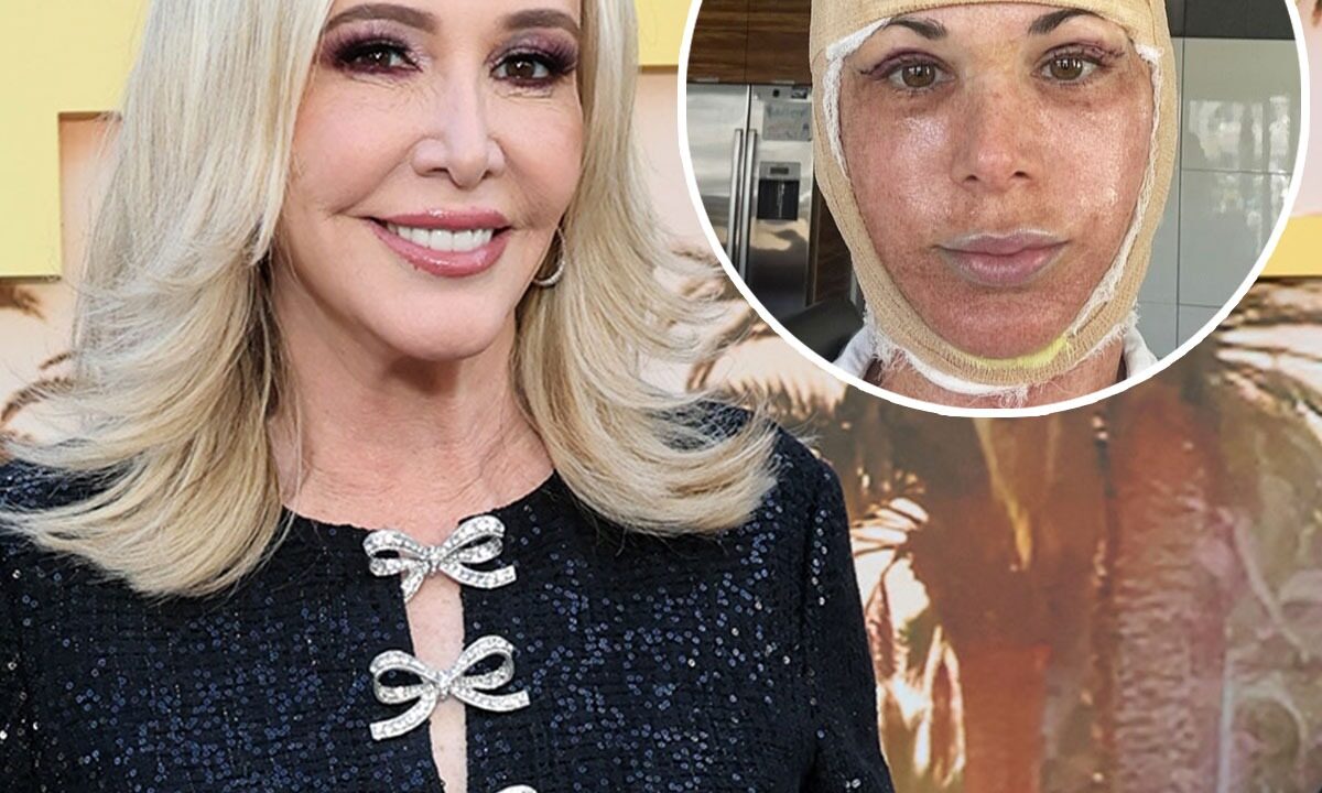 RHOC’s Shannon Beador Shades Alexis Bellino’s Facelift Reveal